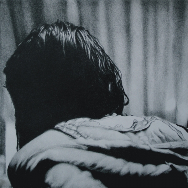Scars